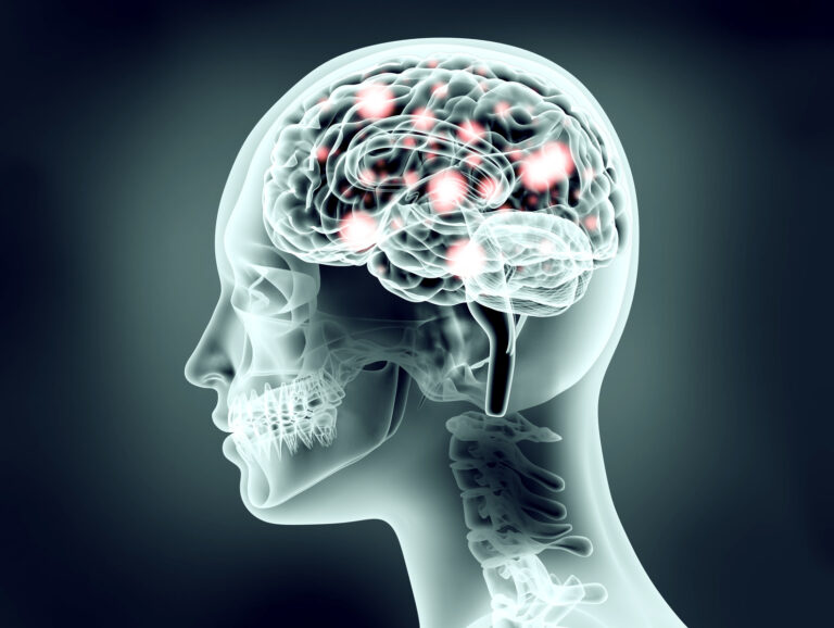 Fotolia_93599366_brain