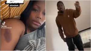 Τουράμ: Διάσημη πορνοστάρ τον καταγγέλλει για κακοποίηση, «Με κλείδωσε και με έσυρε από τον αστράγαλο»