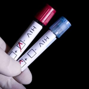 HIV: Πιο κοντά στη θεραπεία του – Νέα τεχνολογία αποκαλύπτει τον ιό μέσα στα κύτταρα