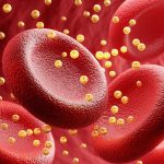 2002233-xolisterolikala1280