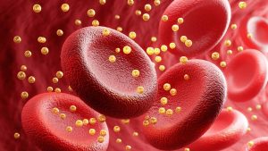 2002233-xolisterolikala1280