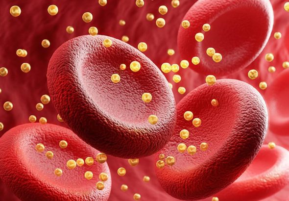 2002233-xolisterolikala1280